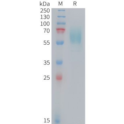 sp-PME M100105 CD98 Fig.1 SDS PAGE 1