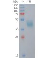 sp-PME M100106 CCR6 Fig.1 SDS PAGE 1