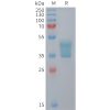 sp-PME M100107 CCR2 Fig.1 SDS PAGE 1