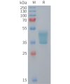 sp-PME M100107 CCR2 Fig.1 SDS PAGE 1