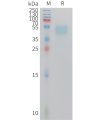 sp-PME M100109 GIPR Fig.1 SDS PAGE 1