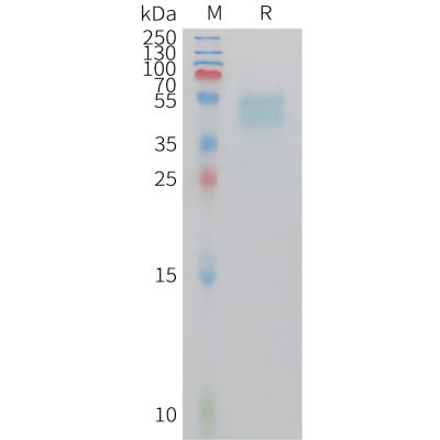 sp-PME M100109 GIPR Fig.1 SDS PAGE 1