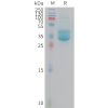sp-PME M100111 PROM1 Fig.1 SDS PAGE 1