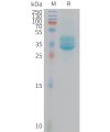 sp-PME M100111 PROM1 Fig.1 SDS PAGE 1