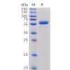 sp-PME100017 CTLA 4 Fig.1 SDS PAGE 1