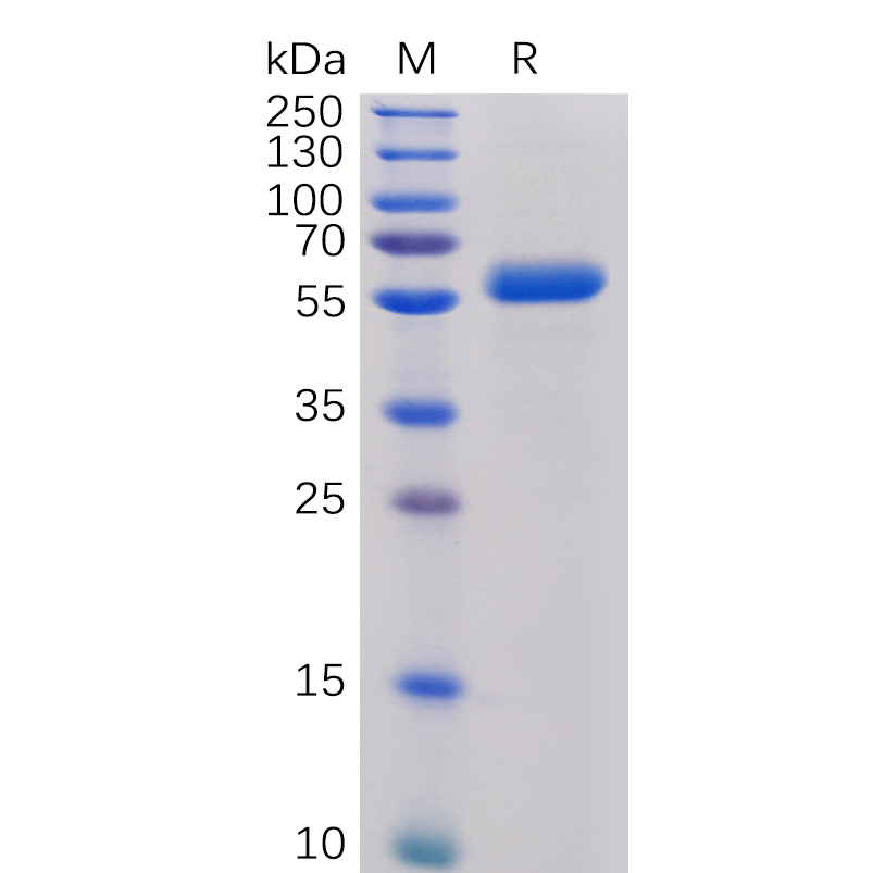 sp-PME100017 CTLA 4 Fig.1 SDS PAGE 1