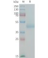 sp-PME100199 CDH17 Fig.1 SDS PAGE 1