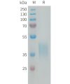 sp-PME100213 CRLF2 Fig.1 SDS PAGE 1