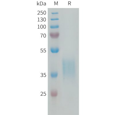 sp-PME100213 CRLF2 Fig.1 SDS PAGE 1