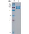 sp-PME100317 KIR2DL1 Fig.1 SDS PAGE 1