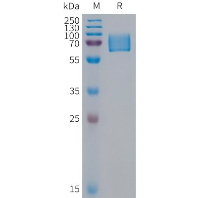 sp-PME100317 KIR2DL1 Fig.1 SDS PAGE 1