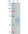 sp-PME100319 KIR2DL3 Fig.1 SDS PAGE 1