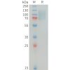 sp-PME100344 MERTK Fig.1 SDS PAGE 1