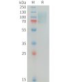 sp-PME100344 MERTK Fig.1 SDS PAGE 1