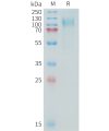 sp-PME100358 MUC16 Fig.1 SDS PAGE 1