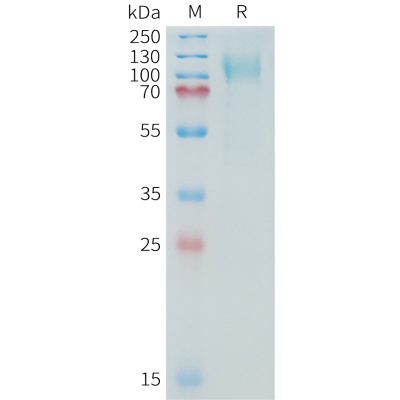 sp-PME100358 MUC16 Fig.1 SDS PAGE 1