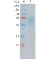 sp-PME100481 CD30 Fig.1 SDS PAGE 1