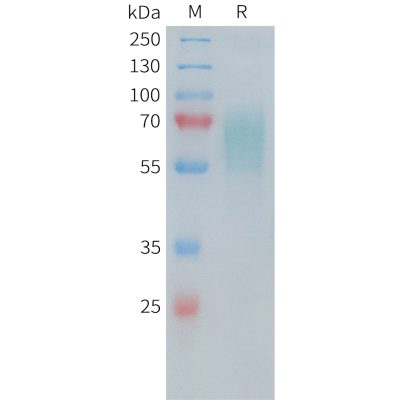 sp-PME100481 CD30 Fig.1 SDS PAGE 1