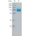 sp-PME100530 CD38 Fig.1 SDS PAGE 1