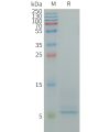 sp-PME100849 CD9 Fig.1 SDS PAGE 1