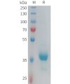 sp-PME100933 CX3CR1 Fig.1 SDS PAGE 1