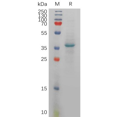 sp-PME100935 CXCL12 Fig.1 SDS PAGE 1