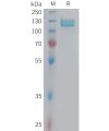 sp-PME100967 ITGB5 Fig.1 SDS PAGE 1