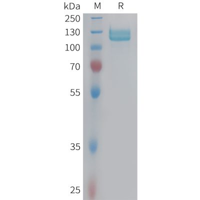 sp-PME100967 ITGB5 Fig.1 SDS PAGE 1