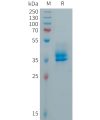 sp-PME101036 CALCA Fig.1 SDS PAGE 1