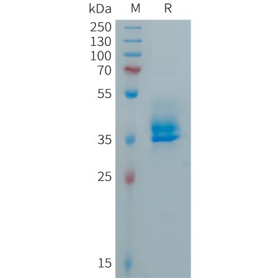 sp-PME101036 CALCA Fig.1 SDS PAGE 1