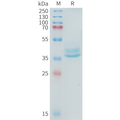 sp-PME101098 ADAM17 Fig.1 SDS PAGE 1