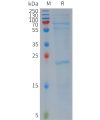 sp-PME101158 NLRP3 Fig.1 SDS PAGE 1