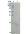 sp-PME101168 CXCL8 Fig.1 SDS PAGE 1