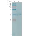 sp-PME101206 CLDN6 Fig.1 SDS PAGE 1