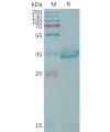 sp-PME101207 CLDN6 Fig.1 SDS PAGE 1