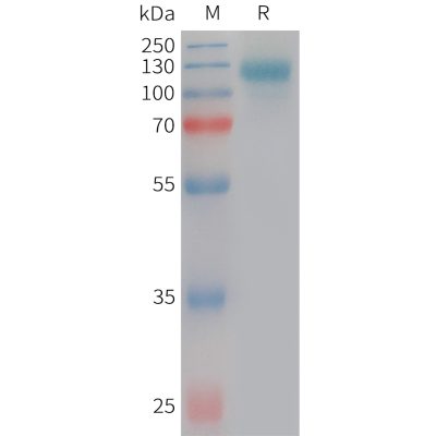 sp-PME101224 SEZ6L2 Fig.1 SDS PAGE 1