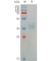 sp-PME101225 AZU1 Fig.1 SDS PAGE 1