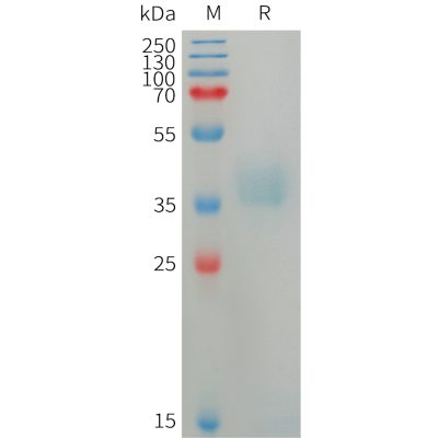 sp-PME101225 AZU1 Fig.1 SDS PAGE 1