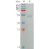 sp-PME101226 ANGPTL7 Fig.1 SDS PAGE 1