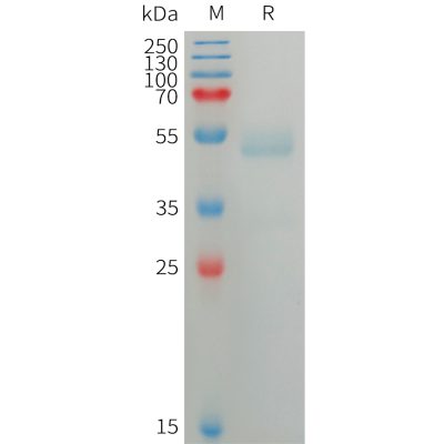 sp-PME101226 ANGPTL7 Fig.1 SDS PAGE 1