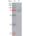 sp-PME101227 ACHE Fig.1 SDS PAGE 1