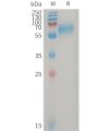 sp-PME101228 GPR56 Fig.1 SDS PAGE 1