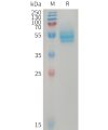 sp-PME101229 CD14 Fig.1 SDS PAGE 1