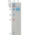 sp-PME101230 CD14 Fig.1 SDS PAGE 1