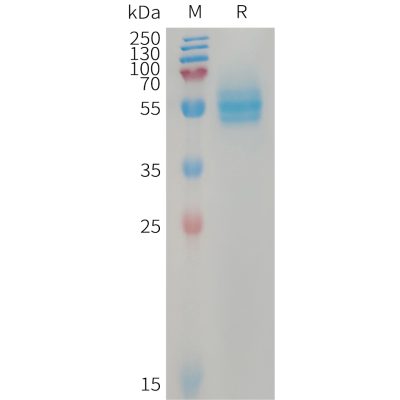 sp-PME101230 CD14 Fig.1 SDS PAGE 1