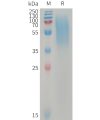 sp-PME101231 LYPD3 Fig.1 SDS PAGE 1