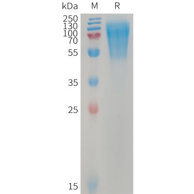 sp-PME101232 LYPD3 Fig.1 SDS PAGE 1