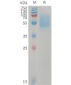 sp-PME101233 ACVR1C Fig.1 SDS PAGE 1