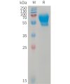 sp-PME101234 ACVRL1 Fig.1 SDS PAGE 1