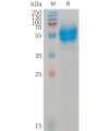 sp-PME101235 BTC Fig.1 SDS PAGE 1